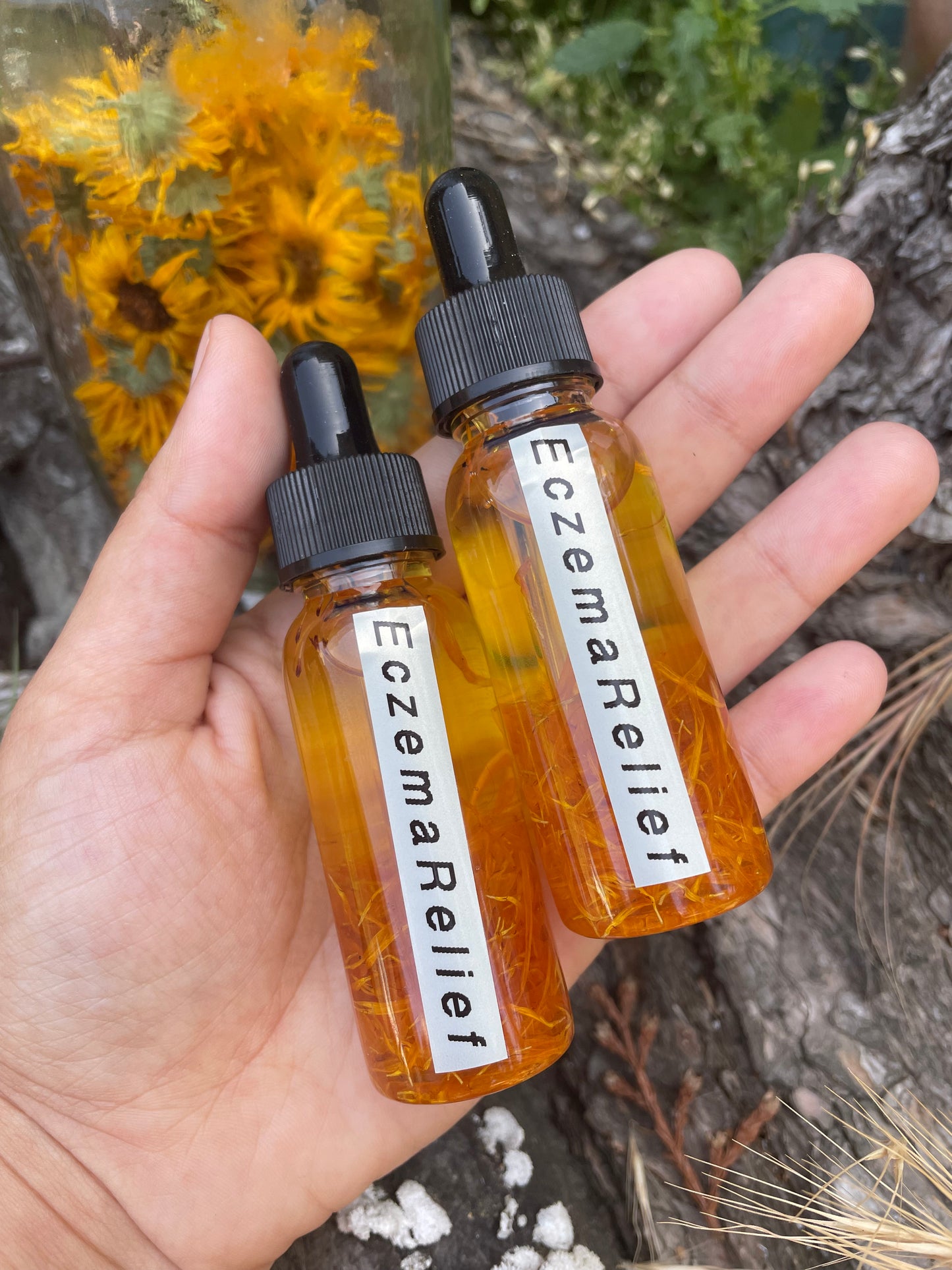 Dry Skin & Eczema Relief Oil- Our World-Famous Calendula Oil